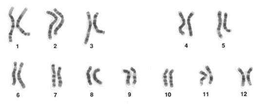 karyotype